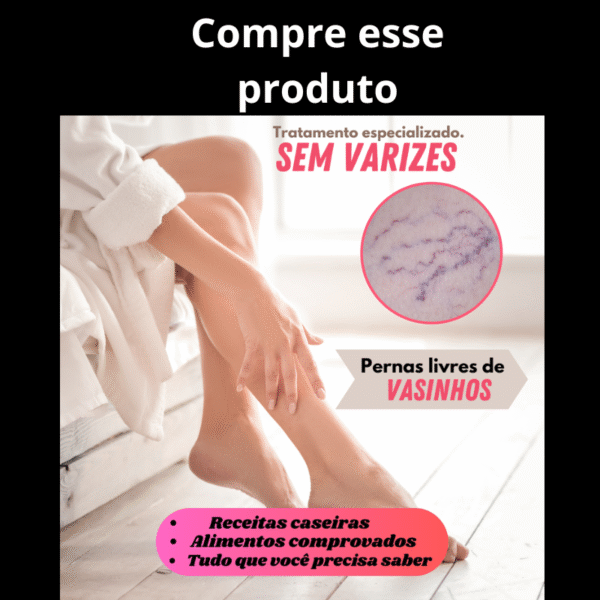 Sem varizes