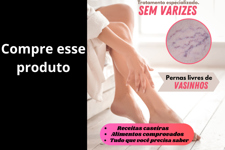 Sem varizes